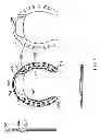 Fig. 03 - Horseshoe with splaying, and stabilizer feature