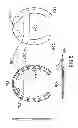 Fig. 06 - Horseshoe with splaying, and stabilizer feature
