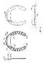 Fig. 07 - Horseshoe with splaying, and stabilizer feature