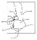Fig. 01 - Cigarette lighter pack