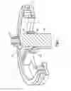 Fig. 04 - FILTER DEVICE AND FILTER ELEMENT FOR SUCH A FILTER DEVICE