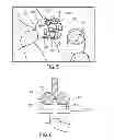 Fig. 06 - Vial spiking assemblies and related methods