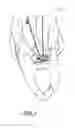 Fig. 02 - ADJUSTABLE GAME CONTROLLER NECK SUPPORTER