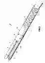 Fig. 10 - Flexible surgical stapler with motor in the head