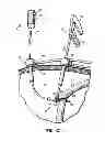 Fig. 24 - Flexible surgical stapler with motor in the head