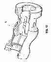 Fig. 34 - Flexible surgical stapler with motor in the head