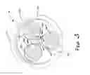Fig. 04 - Adjustable drip emitter