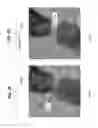 Fig. 09 - Manufacturable sub-3 nanometer palladium gap devices for fixed electrode tunneling recognition