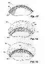 Fig. 07 - Tube diffuser