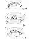 Fig. 09 - Tube diffuser