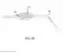 Fig. 15 - Container having a rim or other feature encapsulated by or formed from injection-molded material