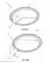 Fig. 49 - Container having a rim or other feature encapsulated by or formed from injection-molded material