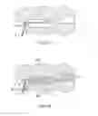Fig. 56 - Container having a rim or other feature encapsulated by or formed from injection-molded material