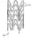 Fig. 01 - Tube expansion processes for semicrystalline polymers to maximize fracture toughness
