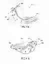 Fig. 13 - Trailing arm suspension beam assembly