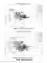 Fig. 147 - SYSTEMS AND METHODS FOR INTRAVENOUS DRUG MANAGEMENT USING IMMITTANCE SPECTROSCOPY