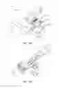Fig. 82 - SYSTEMS AND METHODS FOR INTRAVENOUS DRUG MANAGEMENT USING IMMITTANCE SPECTROSCOPY