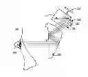 Fig. 01 - ADJUSTING A NEAR-EYE DISPLAY DEVICE