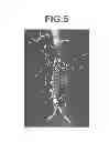 Fig. 04 - Image generation apparatus, method, and medium with image generation program recorded thereon