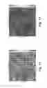 Fig. 11 - METHOD, SYSTEM, SOFTWARE AND MEDIUM FOR ADVANCED IMAGE-BASED ARRAYS FOR ANALYSIS AND DISPLAY OF BIOMEDICAL INFORMATION