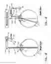 Fig. 04 - Method and apparatus for an attachable unit for a portable wireless system