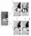 Fig. 07 - Smart prosthesis for facilitating artificial vision using scene abstraction
