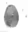 Fig. 08 - Obtaining a biometric image and handling damaged biometrics