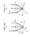 Fig. 12 - SOLID-STATE IMAGING APPARATUS, METHOD OF MANUFACTURING THE SAME, CAMERA,  IMAGING DEVICE, AND IMAGING APPARATUS