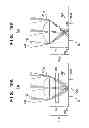 Fig. 19 - SOLID-STATE IMAGING APPARATUS, METHOD OF MANUFACTURING THE SAME, CAMERA,  IMAGING DEVICE, AND IMAGING APPARATUS
