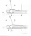 Fig. 08 - Test glass changing