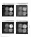 Fig. 08 - Systems for characterizing atherosclerotic plaque and methods of using same