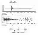 Fig. 01 - Segmenting audio signals into auditory events