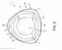 Fig. 09 - Bearing assembly for rock drill