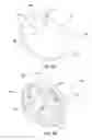 Fig. 04 - Absorbing reflector for semiconductor processing chamber
