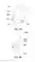 Fig. 08 - Electromechanical system for dispensing deodorant / antiperspirant