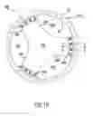 Fig. 17 - ROOT STIFFENER FOR A WIND TURBINE ROTOR BLADE