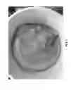 Fig. 07 - SYSTEMS AND METHODS FOR REMOVING FINELY DISPERSED PARTICULATE MATTER FROM A FLUID STREAM