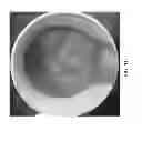 Fig. 11 - SYSTEMS AND METHODS FOR REMOVING FINELY DISPERSED PARTICULATE MATTER FROM A FLUID STREAM