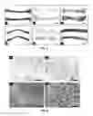 Fig. 04 - Wet-electrospun biodegradable scaffold and uses therefor