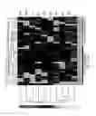 Fig. 04 - GENE EXPRESSION SIGNATURES FOR STAGING AND PROGNOSIS OF PROSTATE, BREAST AND LEUKEMIA CANCERS