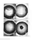 Fig. 02 - METHOD OF PREPARING AN ARTIFICIAL TOOTH PRIMORDIUM IN VITRO AND ARTIFICIALTOOTH PRIMORDIUM DERIVED THEREFROM