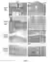 Fig. 02 - ENZYME REPLACEMENT THERAPY FOR TREATING MPS VII RELATED BONE LESIONS USING A CHEMICALLY MODIFIED ENZYME