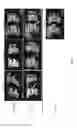 Fig. 08 - ENZYME REPLACEMENT THERAPY FOR TREATING MPS VII RELATED BONE LESIONS USING A CHEMICALLY MODIFIED ENZYME