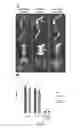 Fig. 09 - ENZYME REPLACEMENT THERAPY FOR TREATING MPS VII RELATED BONE LESIONS USING A CHEMICALLY MODIFIED ENZYME