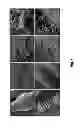 Fig. 09 - MEDICAL DEVICE COMPRISING COLLAGEN-VI