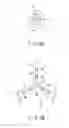 Fig. 06 - Hot-runner molding apparatus and hot-runner nozzle