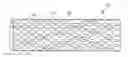 Fig. 01 - Method for forming a coating on a stent