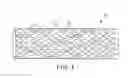 Fig. 02 - Method for forming a coating on a stent