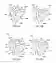 Fig. 18 - Method for forming a coating on a stent