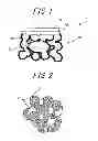 Fig. 02 - FUEL ELECTRODE DOUBLING AS SUPPORT OF SOLID OXIDE FUEL CELL AND FUEL-ELECTRODE-SUPPORTED SOLID OXIDE FUEL CELL